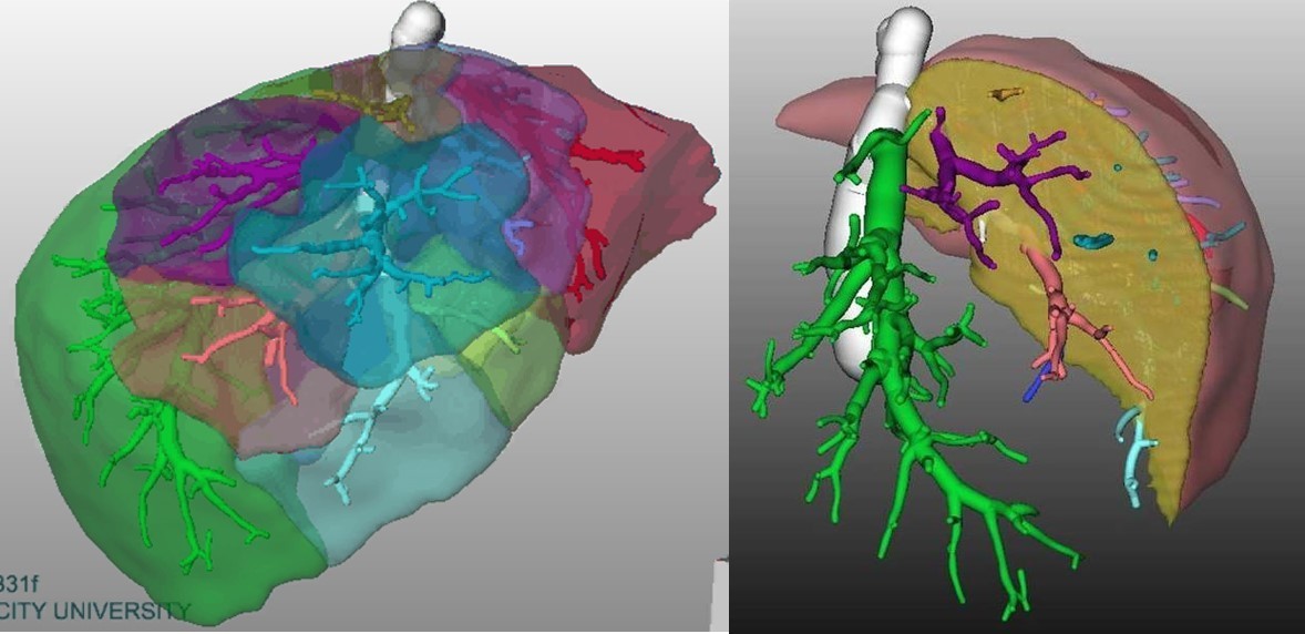 閧晁∮3D-image.jpg