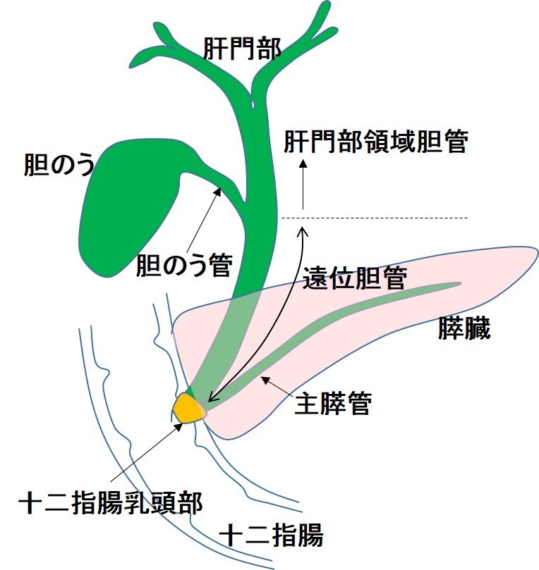 肝外胆道系の区分.jpg