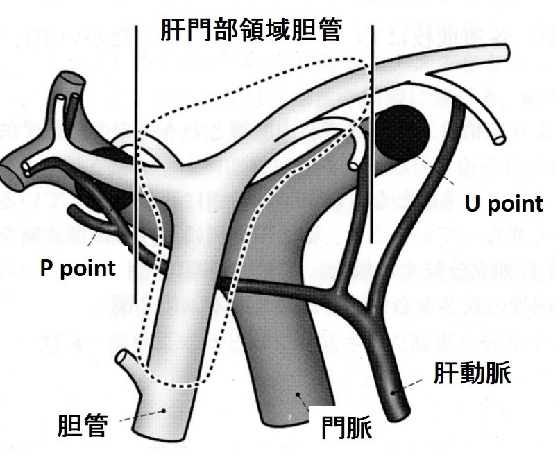 肝門部領域胆管の目安.jpg