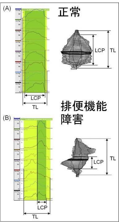 直腸機能.jpg